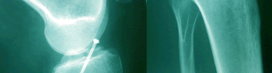 Post Operative Treatment Physiotherapy and Pilates in Cascais